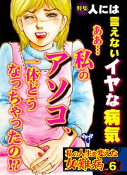 私の人生を変えた女の難病 6巻