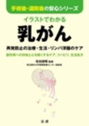 イラストでわかる乳がん