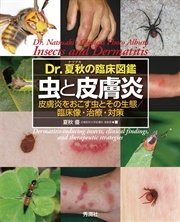 Dr.夏秋の臨床図鑑 虫と皮膚炎