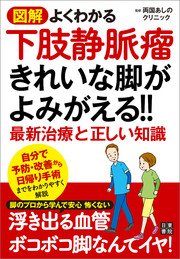 図解 よくわかる下肢静脈瘤 きれいな脚がよみがえる！！ 最新治療と正しい知識