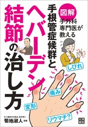 図解 手外科専門医が教える 手根管症候群とヘバーデン結節の治し方