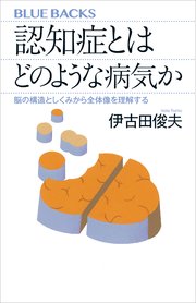 認知症とはどのような病気か 脳の構造としくみから全体像を理解する